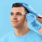 Hair Transplant