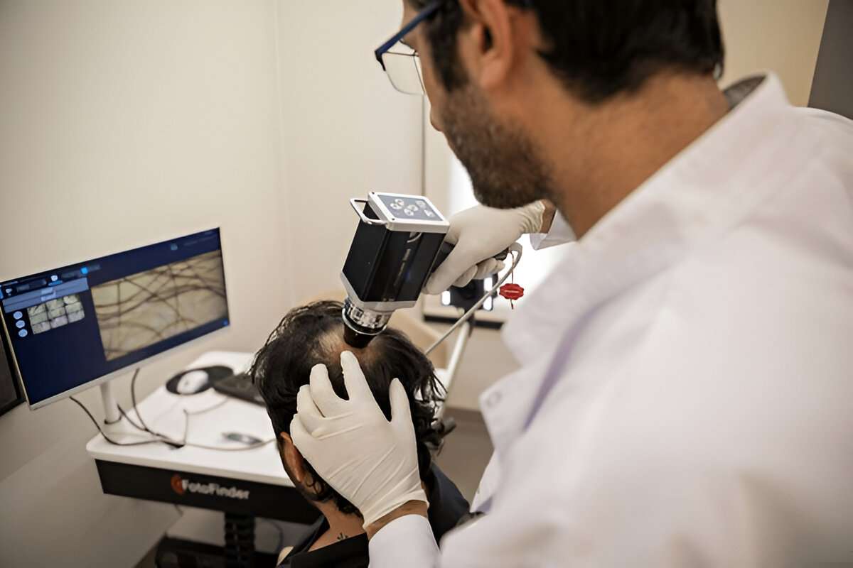 hair transplant