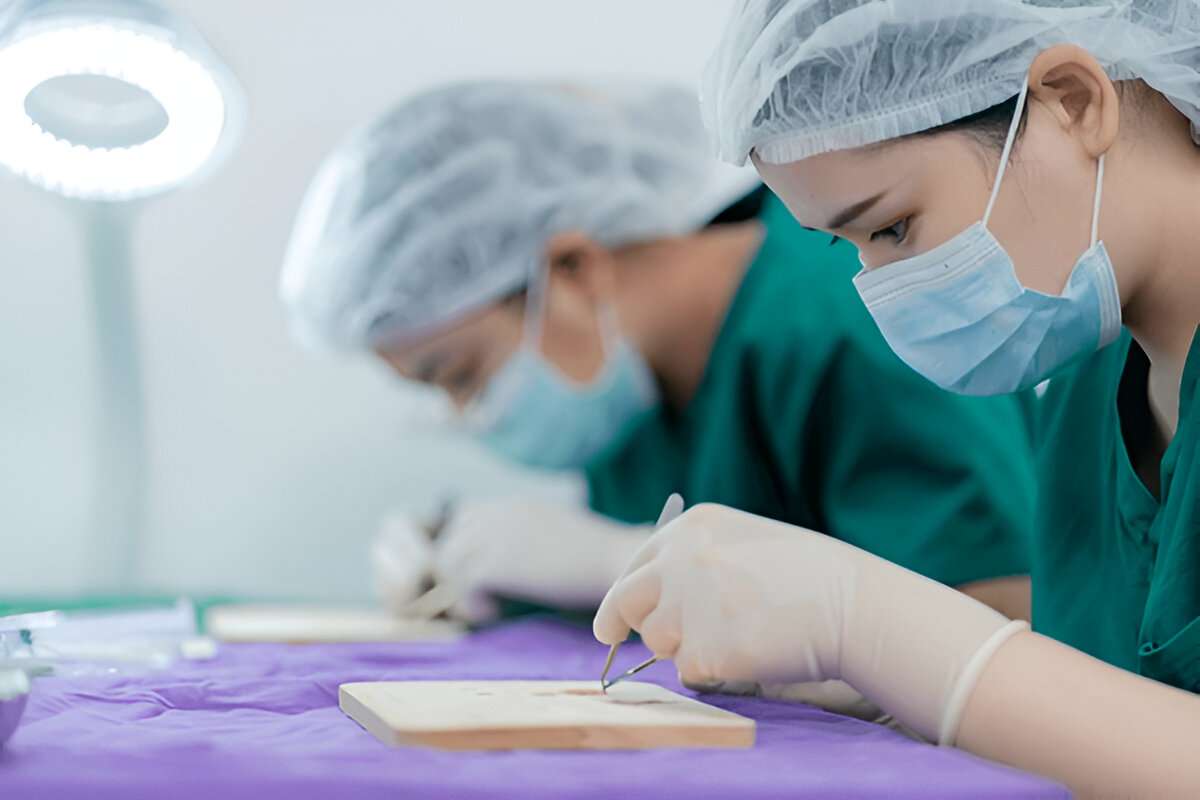 Hair Transplant
