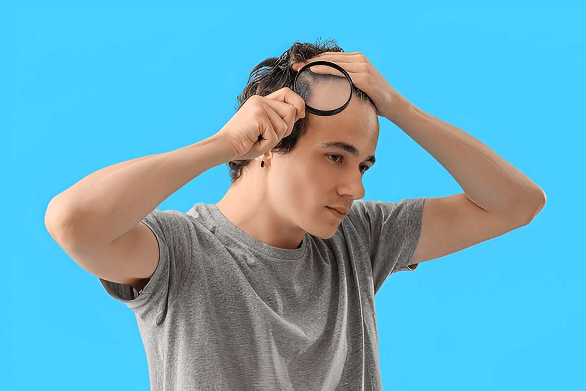 Hair Transplant
