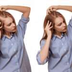 manual hair transplant