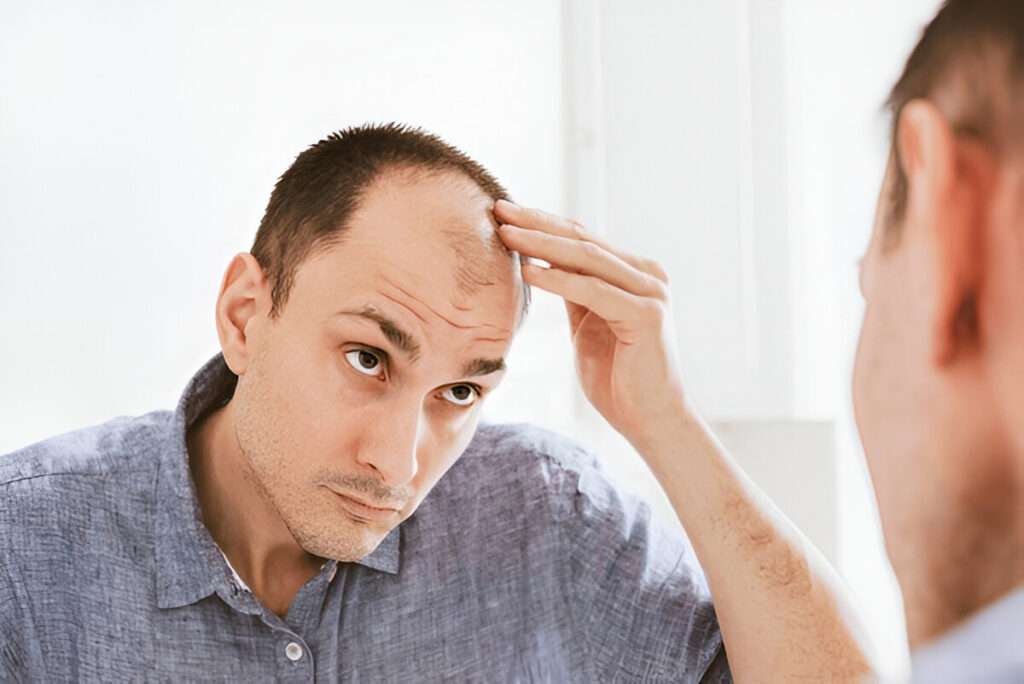hair transplant Cardiff
