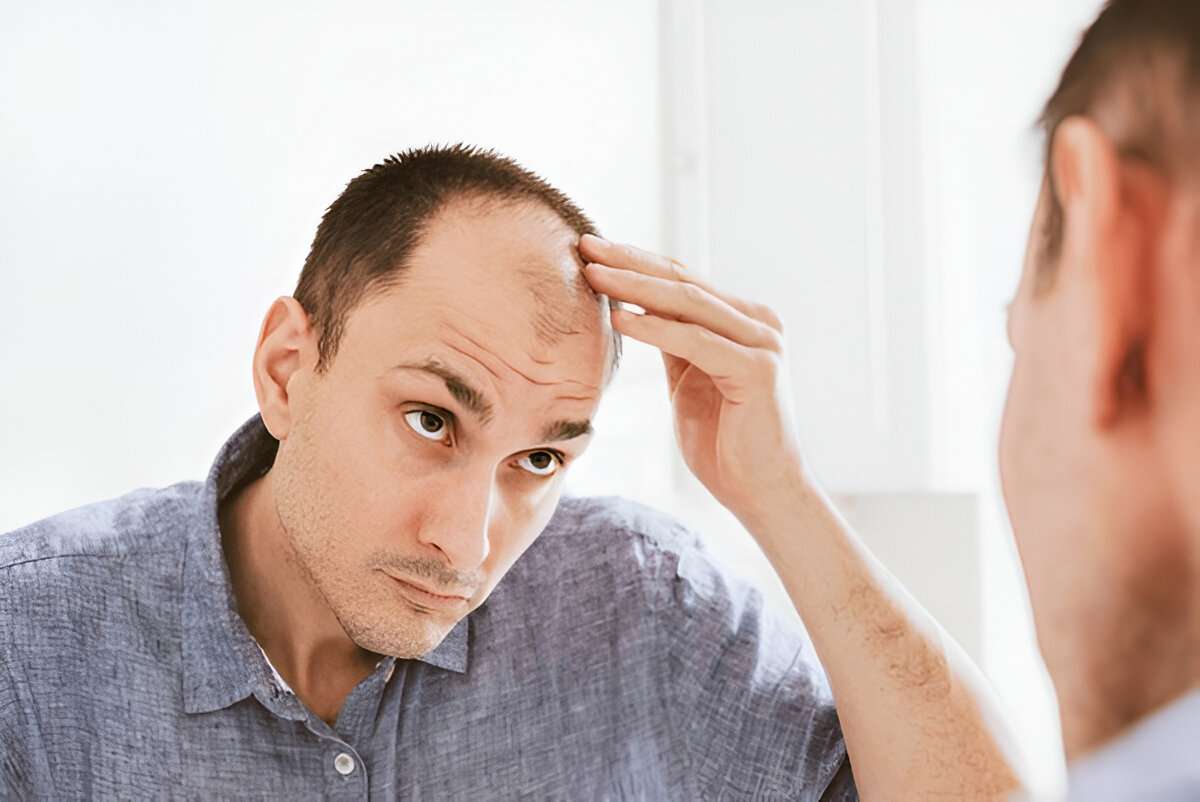 hair transplant Cardiff